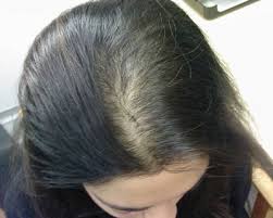 hair loss clinic